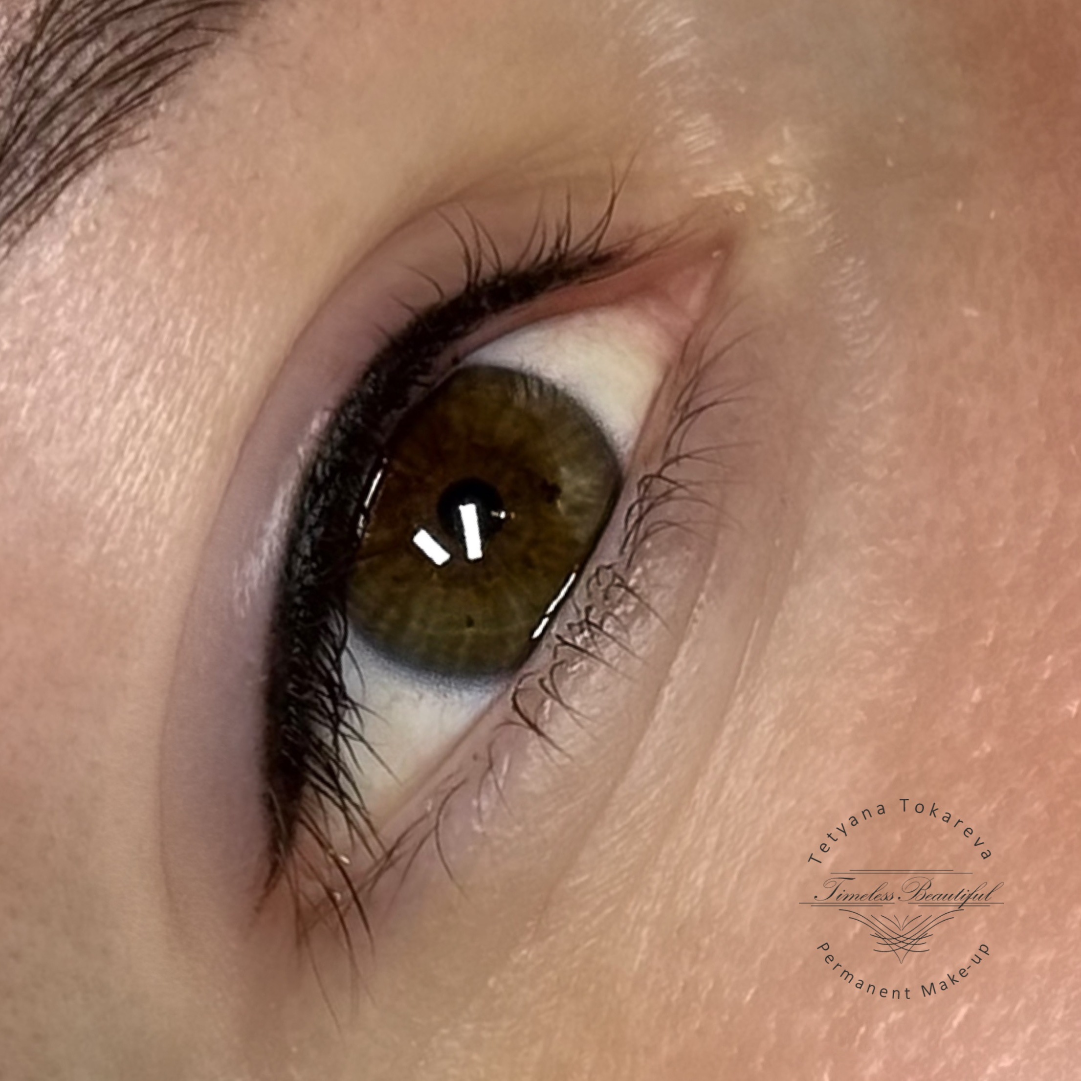 Wimpernkranzverdichtung