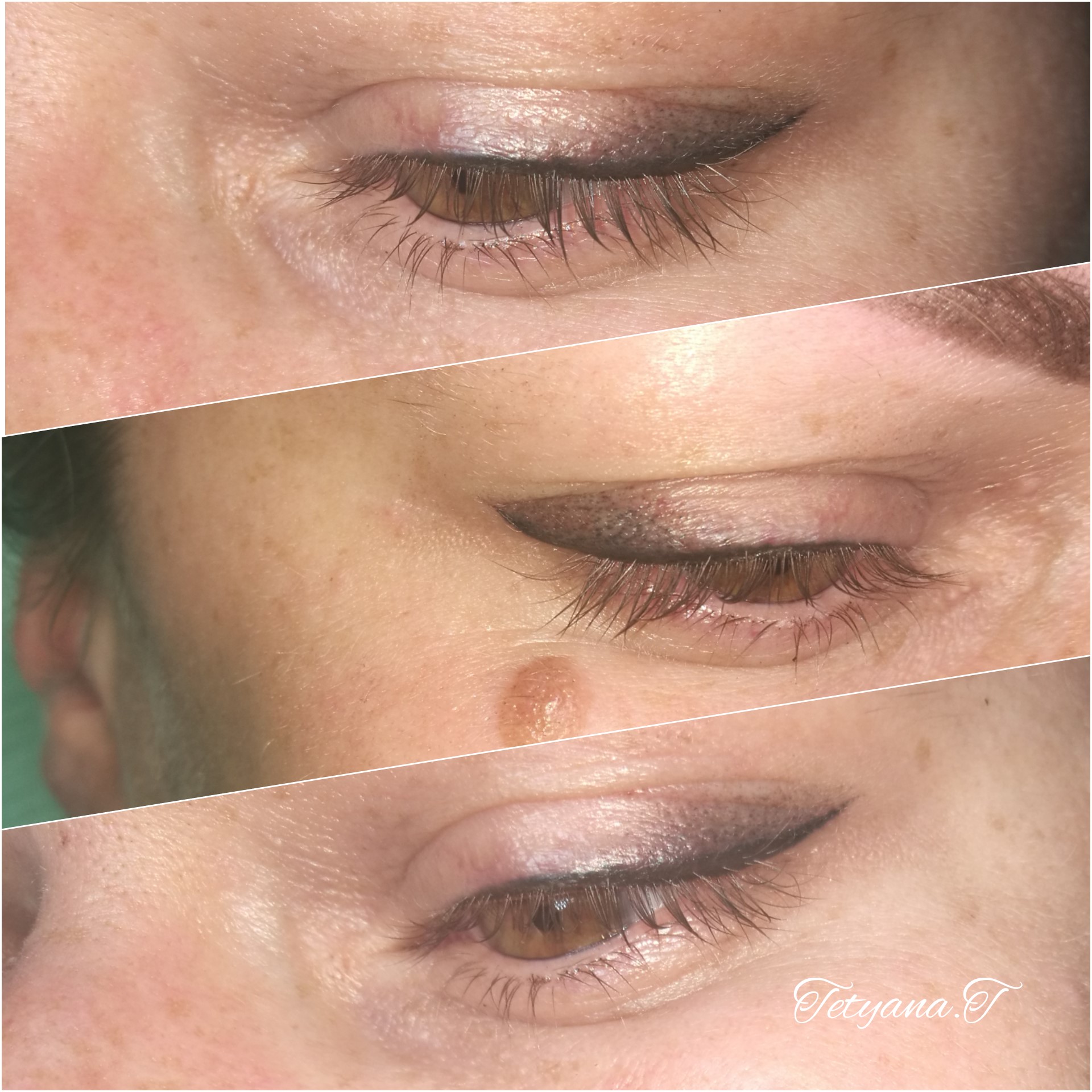 Heilungsprozess Von Permanent Makeup Augenbrauen